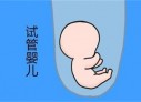 培养武汉捐卵宝宝艺术细胞的小技巧
